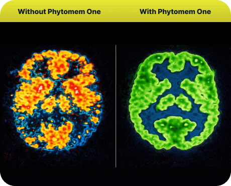 Phytomem - One